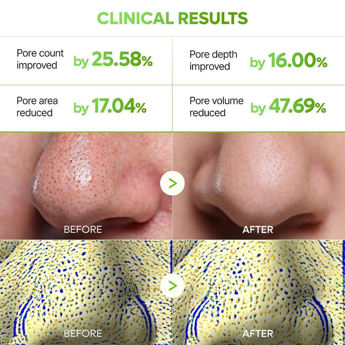 Dr.Melaxin Cactox 3-Step Nose Pore Pack
