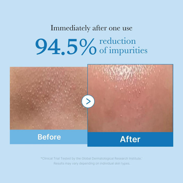 Medicube Zero Pore Cleansing Oil 205 mL